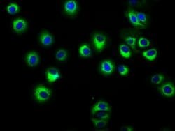 Invitrogen HLA-ABC Polyclonal Antibody 100 &mu;g; Unconjugated:Antibodies,