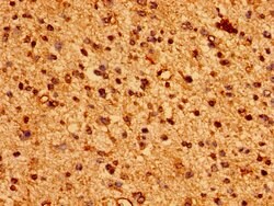 Invitrogen HLA-ABC Polyclonal Antibody 100 &mu;g; Unconjugated:Antibodies,
