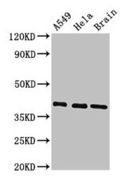 Invitrogen HLA-ABC Polyclonal Antibody 100 &mu;g; Unconjugated:Antibodies,