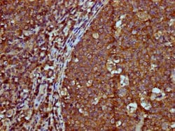 Invitrogen IGHM Polyclonal Antibody 100 &mu;g; Unconjugated:Antibodies,