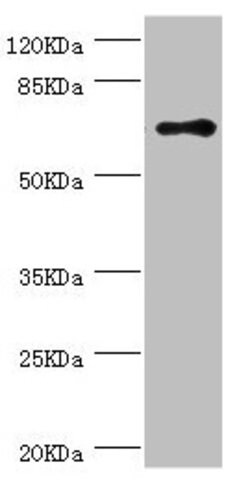 HCE Polyclonal Antibody:Antibodies, Polyclonal