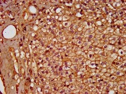 Invitrogen PDE9A Polyclonal Antibody 100 &mu;g; Unconjugated:Antibodies,