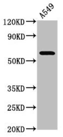 Invitrogen PDE9A Polyclonal Antibody 100 &mu;g; Unconjugated:Antibodies,
