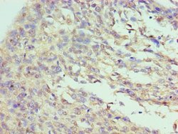 ILF3 Polyclonal Antibody, Invitrogen 100 &mu;L; Unconjugated:Antibodies,
