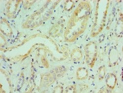 ILF3 Polyclonal Antibody, Invitrogen 100 &mu;L; Unconjugated:Antibodies,