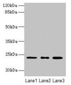 Invitrogen ICT1 Polyclonal Antibody 100 &mu;g | Buy Online | Invitrogen&trade; | Fisher Scientific