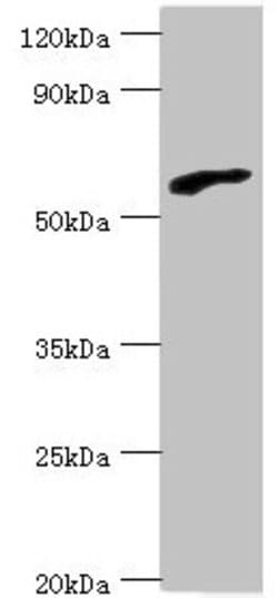 Invitrogen RBBP5 Polyclonal Antibody 100 &mu;L; Unconjugated:Antibodies,
