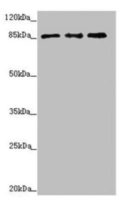 Invitrogen TAF5 Polyclonal Antibody 100 &mu;L | Buy Online | Invitrogen&trade; | Fisher Scientific
