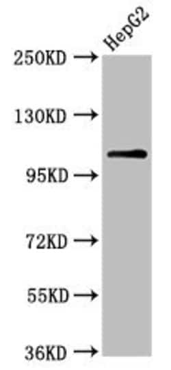 Invitrogen USP4 Polyclonal Antibody 100 &mu;g; Unconjugated:Antibodies,