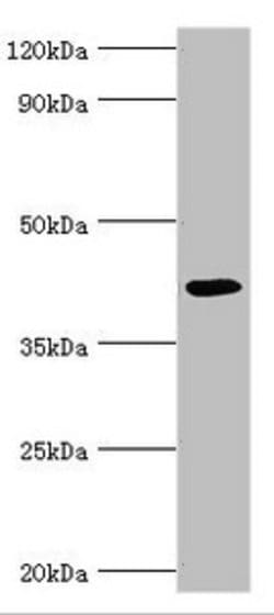 Invitrogen ABH1 Polyclonal Antibody 100 &mu;L; Unconjugated:Antibodies,