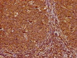 Invitrogen RABEP1 Polyclonal Antibody 100 &mu;L; Unconjugated:Antibodies,