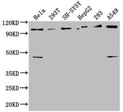 Invitrogen RABEP1 Polyclonal Antibody 100 &mu;L; Unconjugated:Antibodies,