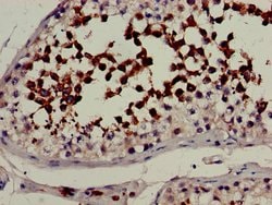 Invitrogen CYP51A1 Polyclonal Antibody 100 &mu;g; Unconjugated:Antibodies,