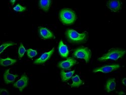 Invitrogen NAIP Polyclonal Antibody 100 &mu;g; Unconjugated:Antibodies,