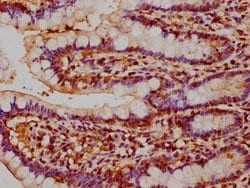 Invitrogen NAIP Polyclonal Antibody 100 &mu;g; Unconjugated:Antibodies,