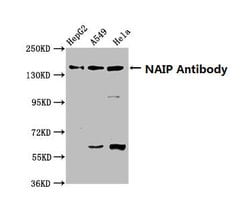 Invitrogen NAIP Polyclonal Antibody 100 &mu;g; Unconjugated:Antibodies,