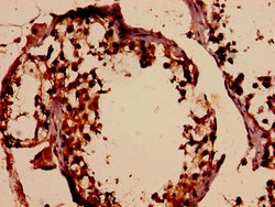 Invitrogen DMC1 Polyclonal Antibody 100 &mu;g; Unconjugated:Antibodies,