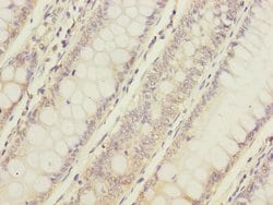 Invitrogen C12orf30 Polyclonal Antibody 100 &mu;L; Unconjugated:Antibodies,