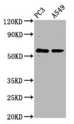 Invitrogen CYP1B1 Polyclonal Antibody 100 &mu;g; Unconjugated:Antibodies,