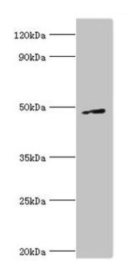 Invitrogen CtBP1 Polyclonal Antibody 100 &mu;L | Buy Online | Invitrogen&trade; | Fisher Scientific