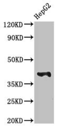Invitrogen MAdCAM-1 Polyclonal Antibody 100 &mu;g | Buy Online | Invitrogen&trade; | Fisher Scientific