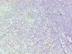 Invitrogen hnRNP D Polyclonal Antibody 100 &mu;L; Unconjugated:Antibodies,