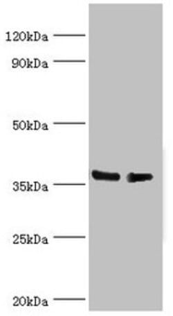 Invitrogen hnRNP D Polyclonal Antibody 100 &mu;L; Unconjugated:Antibodies,