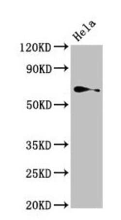 ASC1 Polyclonal Antibody:Antibodies, Polyclonal