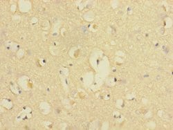 Invitrogen CD226 (DNAM-1) Polyclonal Antibody 100 &mu;L; Unconjugated:Antibodies,