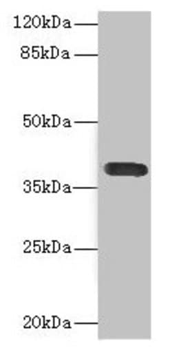 Invitrogen CD226 (DNAM-1) Polyclonal Antibody 100 &mu;L; Unconjugated:Antibodies,