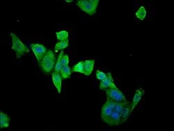 Invitrogen ETFDH Polyclonal Antibody 100 &mu;L; Unconjugated:Antibodies,