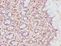 Invitrogen ETFDH Polyclonal Antibody 100 &mu;L; Unconjugated:Antibodies,