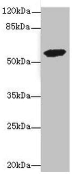 Invitrogen ETFDH Polyclonal Antibody 100 &mu;L; Unconjugated:Antibodies,