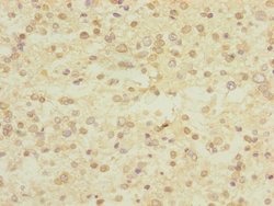 Invitrogen UBE4A Polyclonal Antibody 100 &mu;L | Buy Online | Invitrogen&trade; | Fisher Scientific