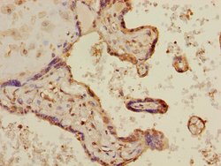MAPKAPK3 Polyclonal Antibody:Antibodies, Polyclonal