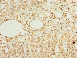 Invitrogen TFCP2 Polyclonal Antibody 100 &mu;L; Unconjugated:Antibodies,