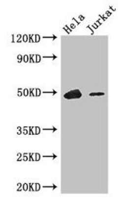 IKAROS Polyclonal Antibody:Antibodies, Polyclonal