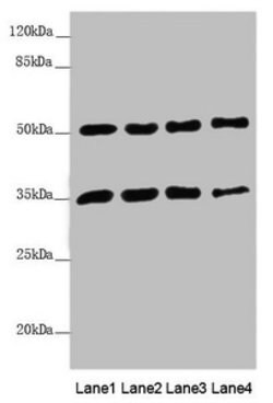 Invitrogen MTX1 Polyclonal Antibody 100 &mu;L; Unconjugated:Antibodies,