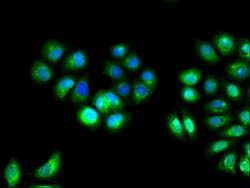 Invitrogen IL10RA Polyclonal Antibody 100 &mu;g; Unconjugated:Antibodies,