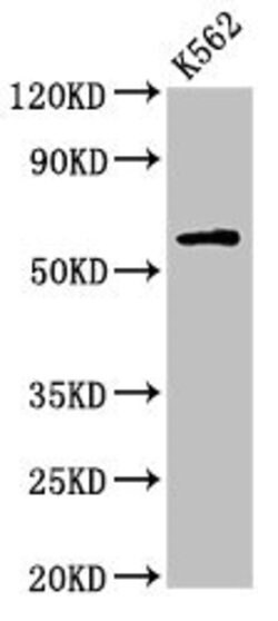Invitrogen IL10RA Polyclonal Antibody 100 &mu;g; Unconjugated:Antibodies,