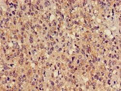 TUBA3C Polyclonal Antibody:Antibodies, Polyclonal