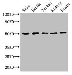 TUBA3C Polyclonal Antibody:Antibodies, Polyclonal