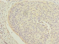 Cytokeratin 33B Polyclonal Antibody:Antibodies, Polyclonal