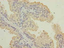 Cytokeratin 33B Polyclonal Antibody:Antibodies, Polyclonal