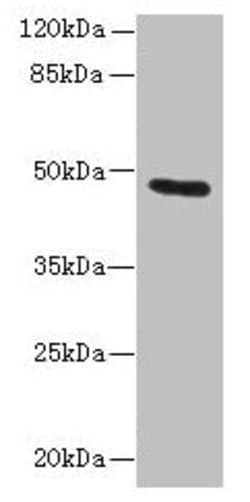 Cytokeratin 33B Polyclonal Antibody:Antibodies, Polyclonal