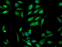 Invitrogen RAB3GAP1 Polyclonal Antibody 100 &mu;g; Unconjugated:Antibodies,