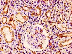 Invitrogen RAB3GAP1 Polyclonal Antibody 100 &mu;g; Unconjugated:Antibodies,