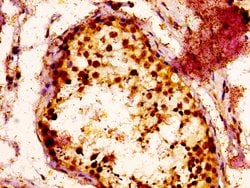 Invitrogen RAB3GAP1 Polyclonal Antibody 100 &mu;g; Unconjugated:Antibodies,