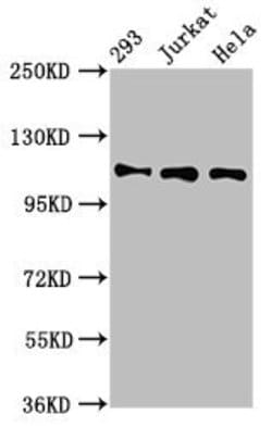 Invitrogen RAB3GAP1 Polyclonal Antibody 100 &mu;g; Unconjugated:Antibodies,