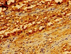 Invitrogen TRADD Polyclonal Antibody 100 &mu;g; Unconjugated:Antibodies,
